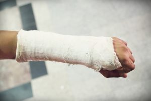 Learn About How To Claim For A Broken Arm 