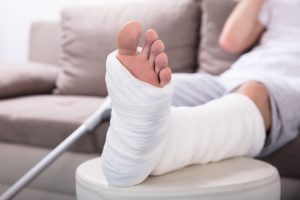 Public accident claims can be made for some leg injuries. 